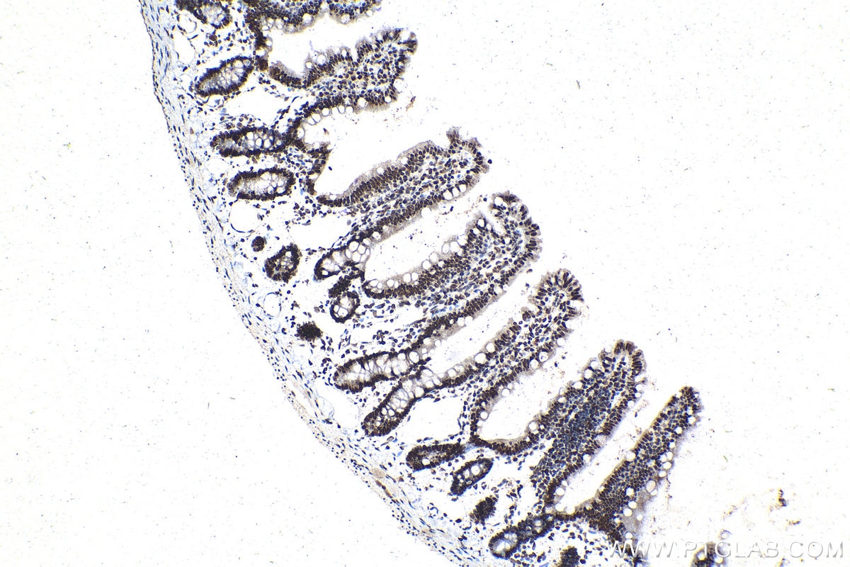 IHC staining of rat small intestine using 15423-1-AP Immunohistochemistry (IHC) staining of rat small intestine tissue using CDK2AP2 Polyclonal antibody (15423-1-AP)