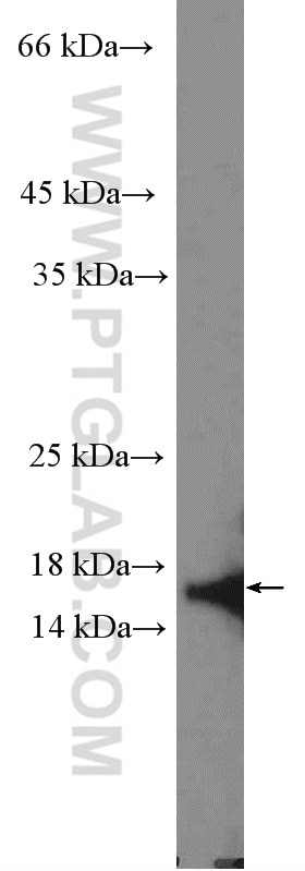 Western Blot (WB) analysis of HeLa cells using CDK2AP2 Polyclonal antibody (15423-1-AP)