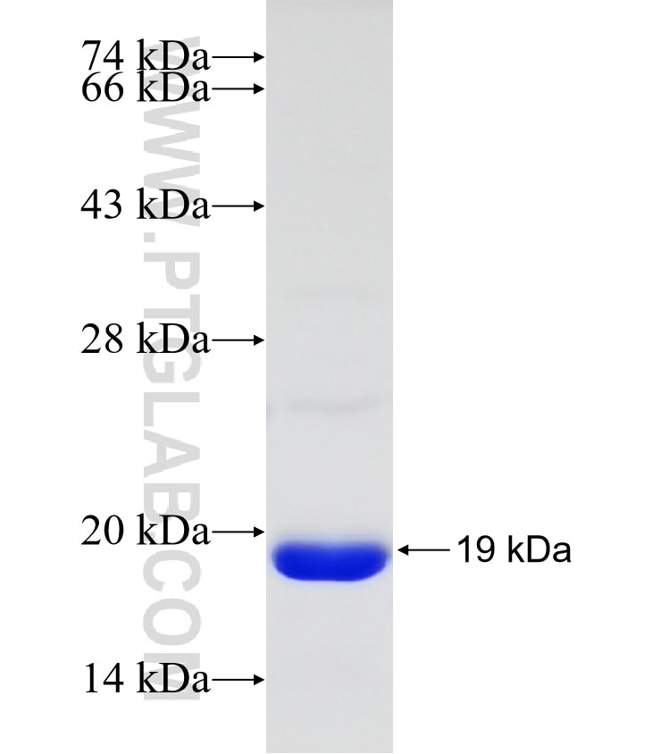 CDK2AP2 fusion protein Ag7739 SDS-PAGE