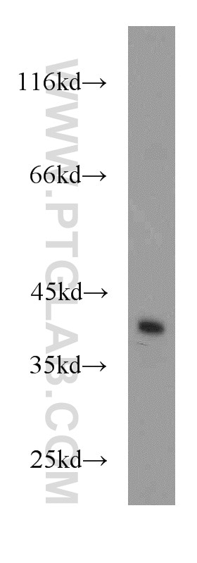 Western Blot (WB) analysis of MCF-7 cells using CDK3 Polyclonal antibody (55103-1-AP)