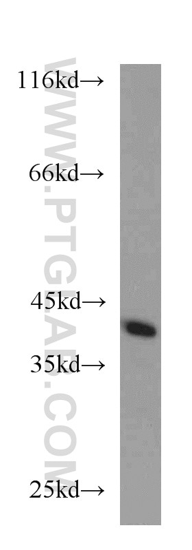 Western Blot (WB) analysis of Jurkat cells using CDK3 Polyclonal antibody (55103-1-AP)