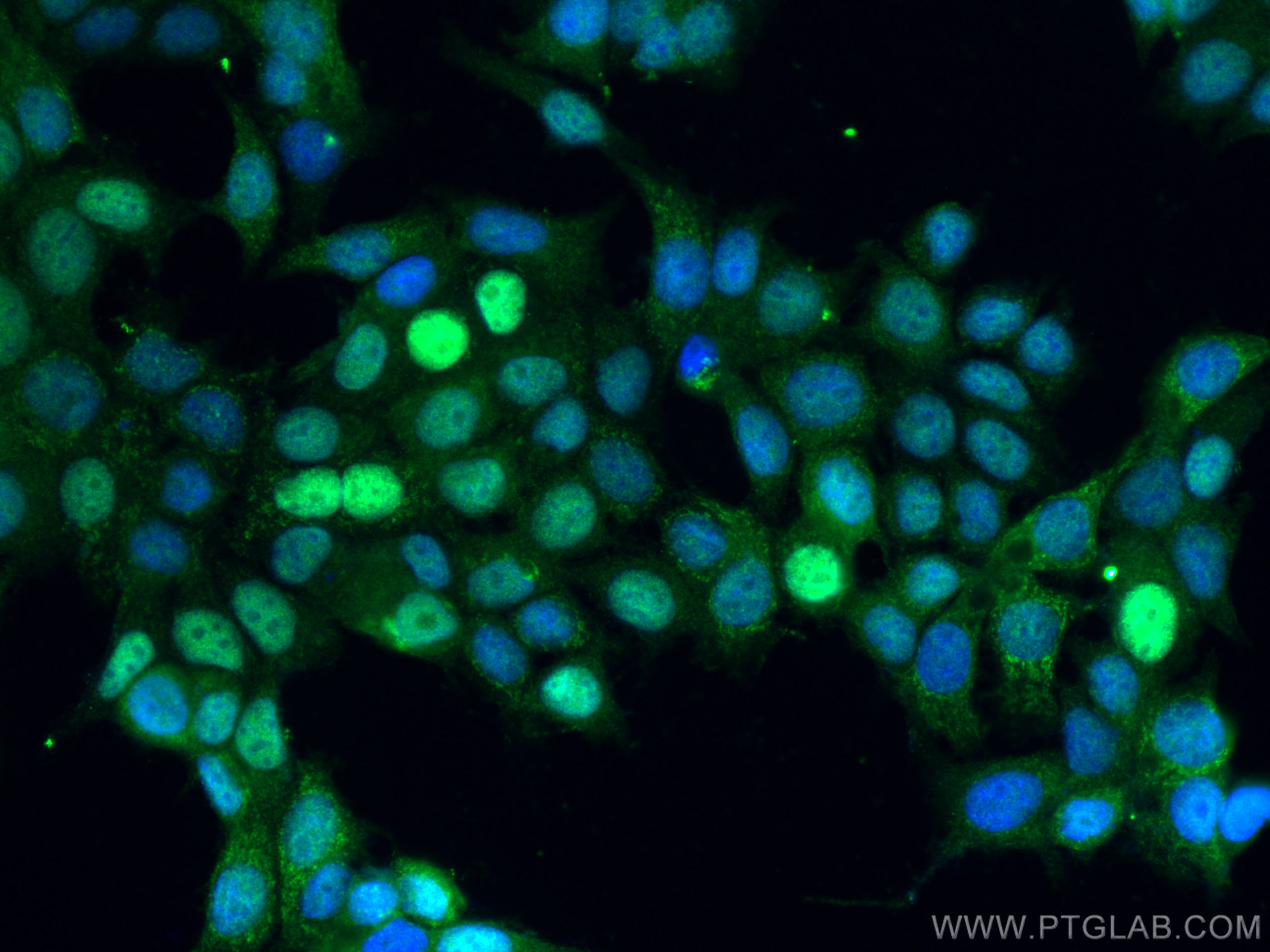 Immunofluorescence (IF) / fluorescent staining of MCF-7 cells using CDK4 Polyclonal antibody (11026-1-AP)