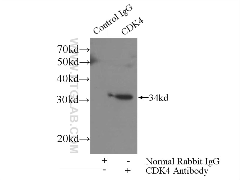 Immunoprecipitation (IP) experiment of HeLa cells using CDK4 Polyclonal antibody (11026-1-AP)