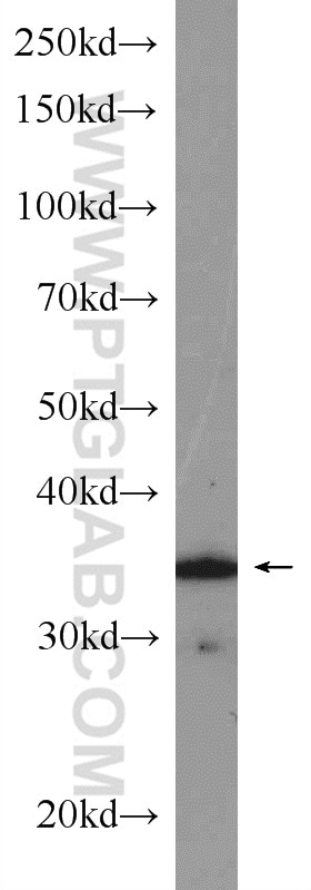 Western Blot (WB) analysis of rat pancreas tissue using CDK4 Polyclonal antibody (11026-1-AP)