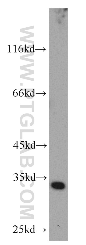 CDK4 Polyclonal antibody