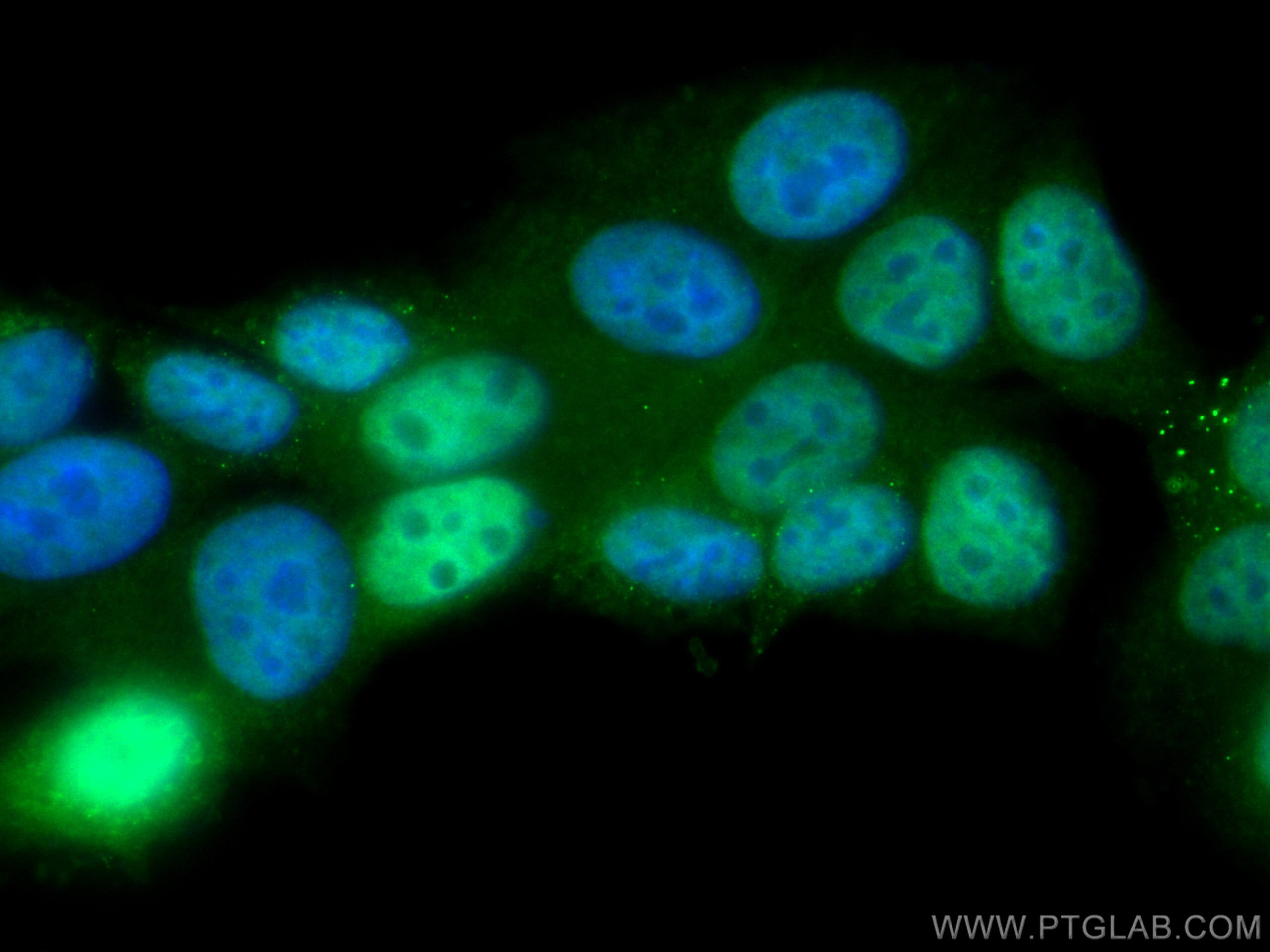 CDK4