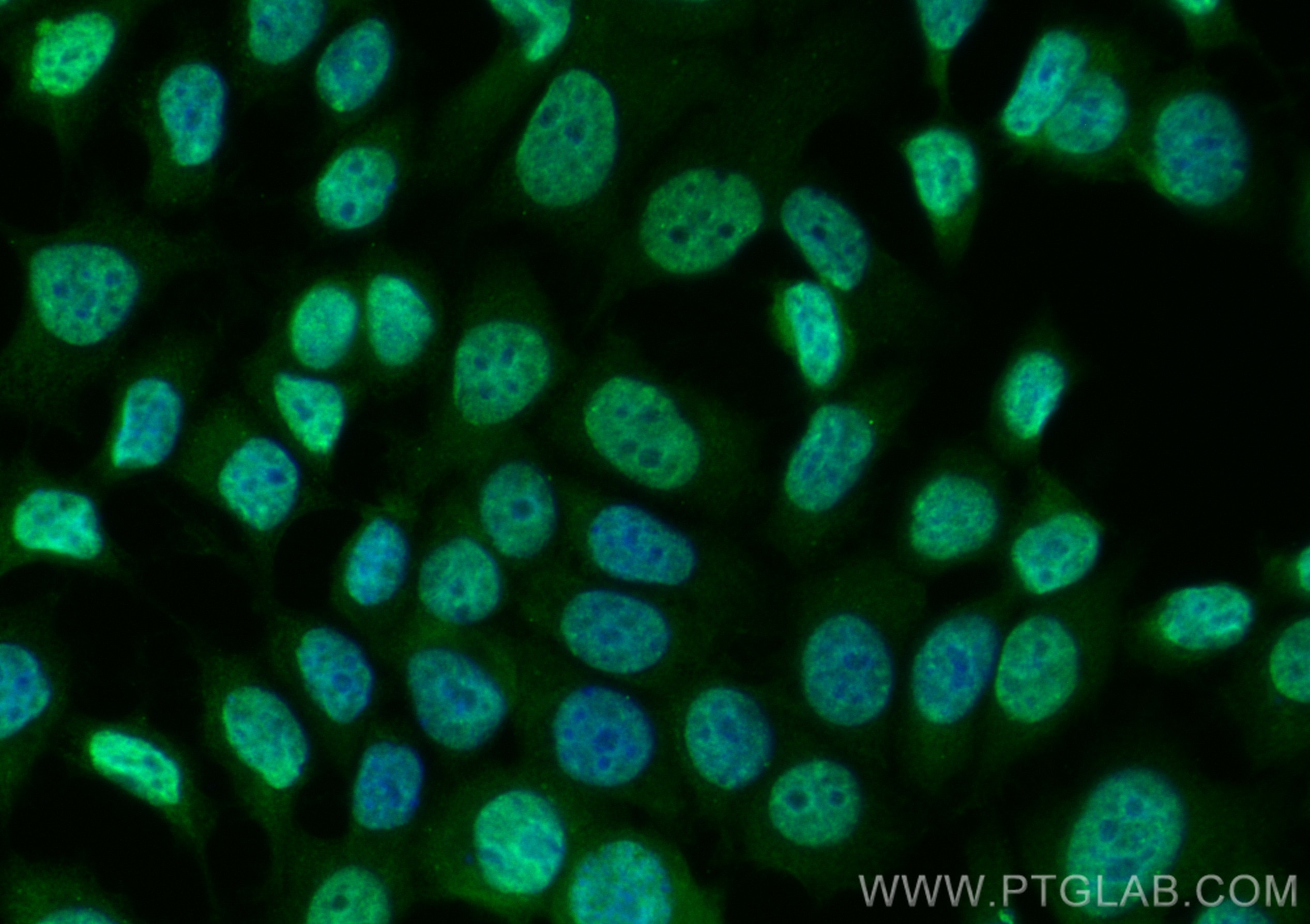 Immunofluorescence (IF) / fluorescent staining of MCF-7 cells using CoraLite® Plus 488-conjugated CDK4 Polyclonal anti (CL488-11026)