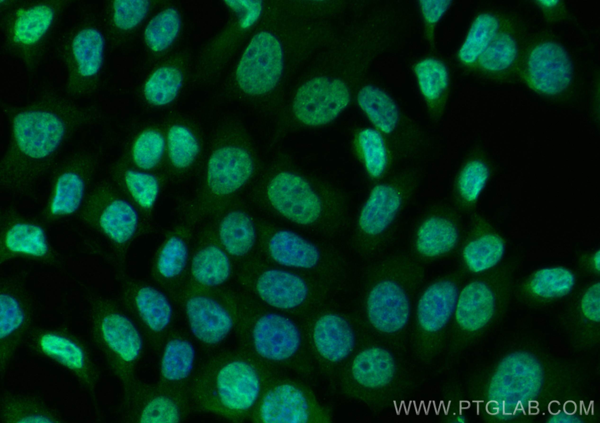 IF Staining of MCF-7 using CL488-11026