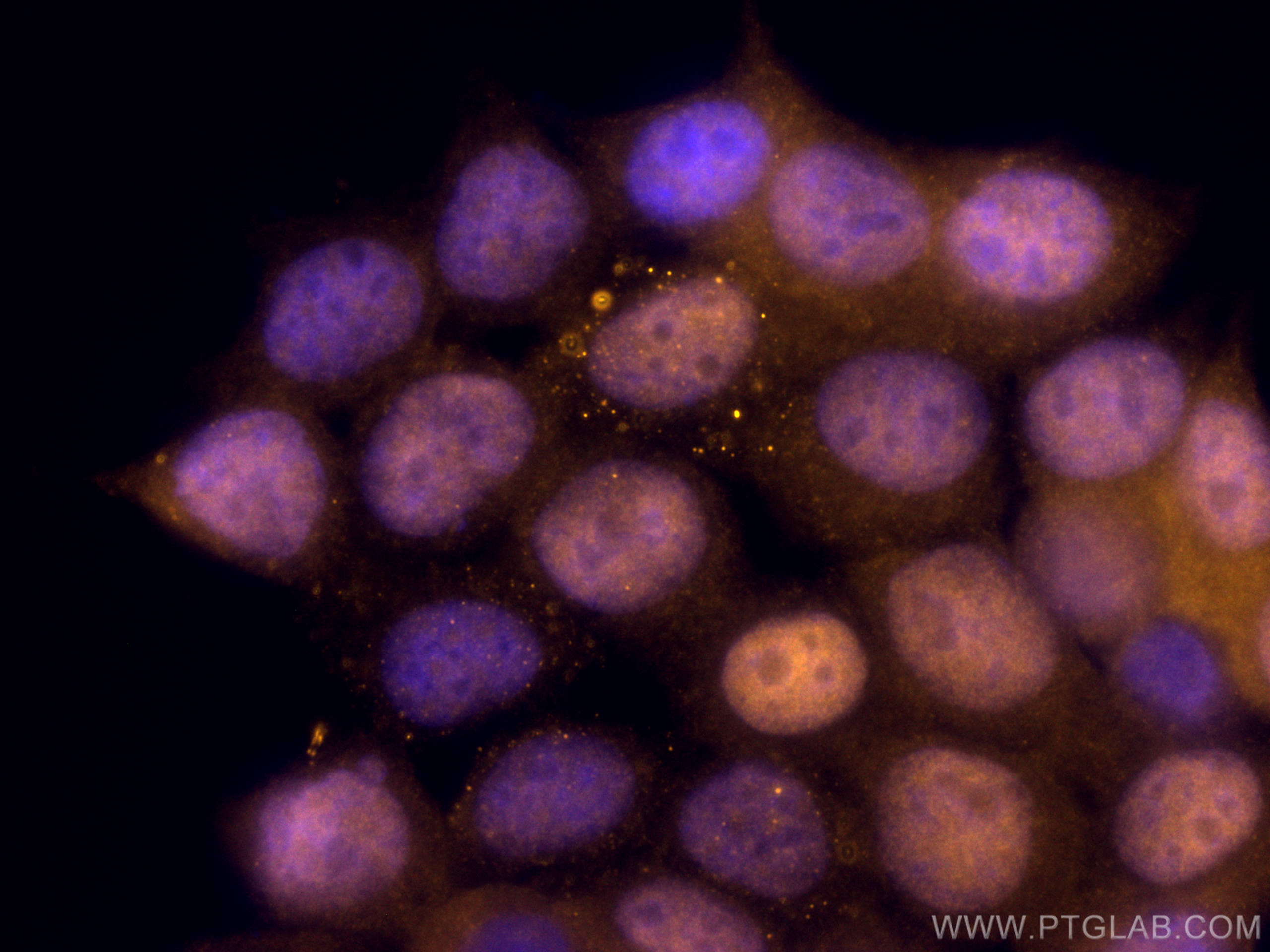 Immunofluorescence (IF) / fluorescent staining of MCF-7 cells using CoraLite®555-conjugated CDK4 Polyclonal antibody (CL555-11026)