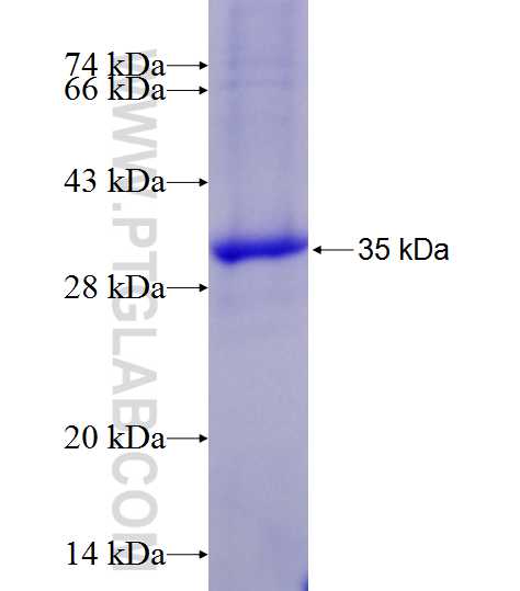 CDK4 fusion protein Ag20538 SDS-PAGE