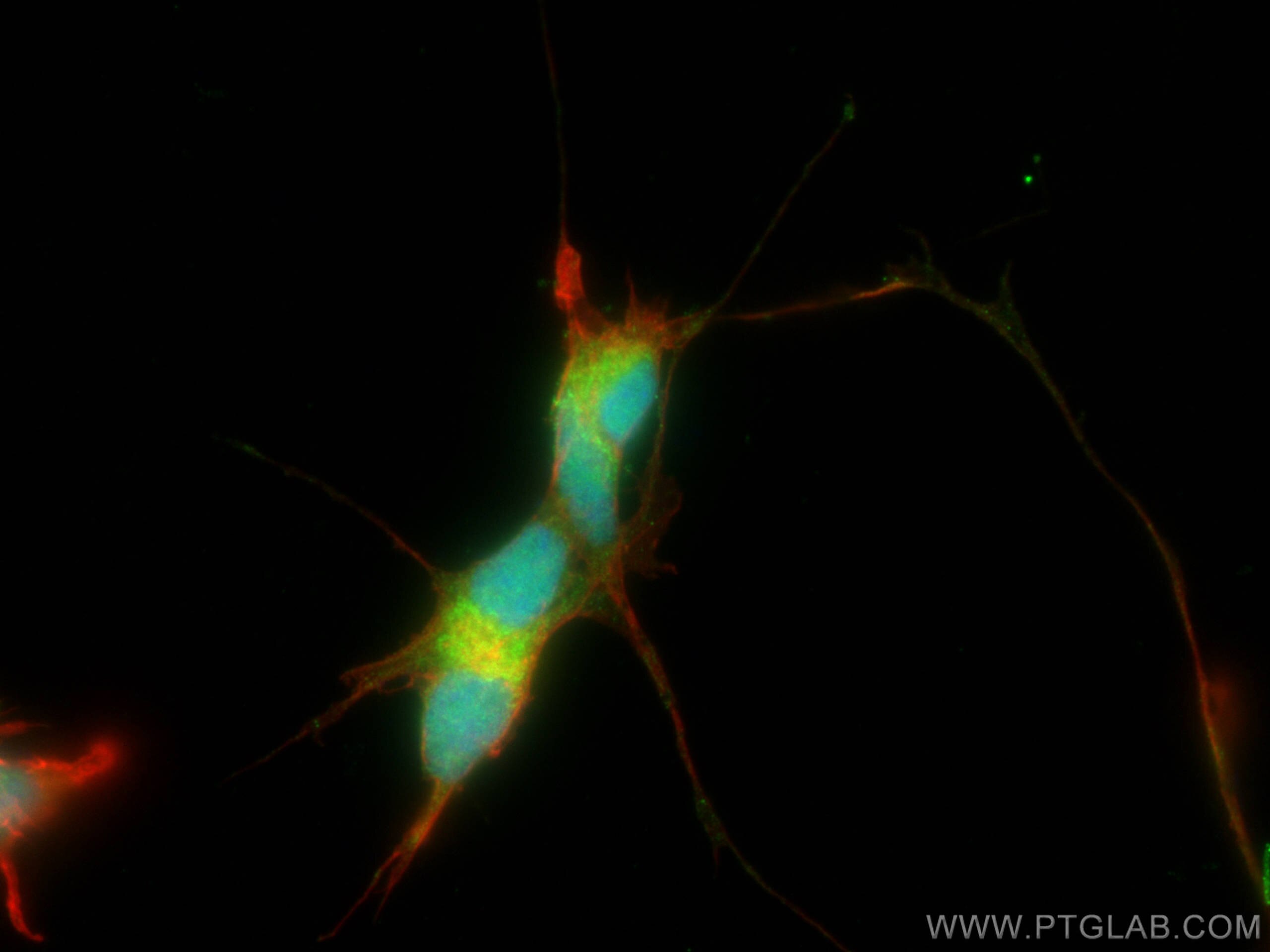 Immunofluorescence (IF) / fluorescent staining of SH-SY5Y cells using CDK5 Polyclonal antibody (10430-1-AP)