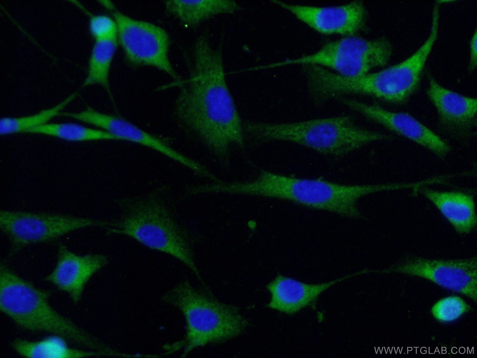 IF Staining of NIH/3T3 using 10430-1-AP