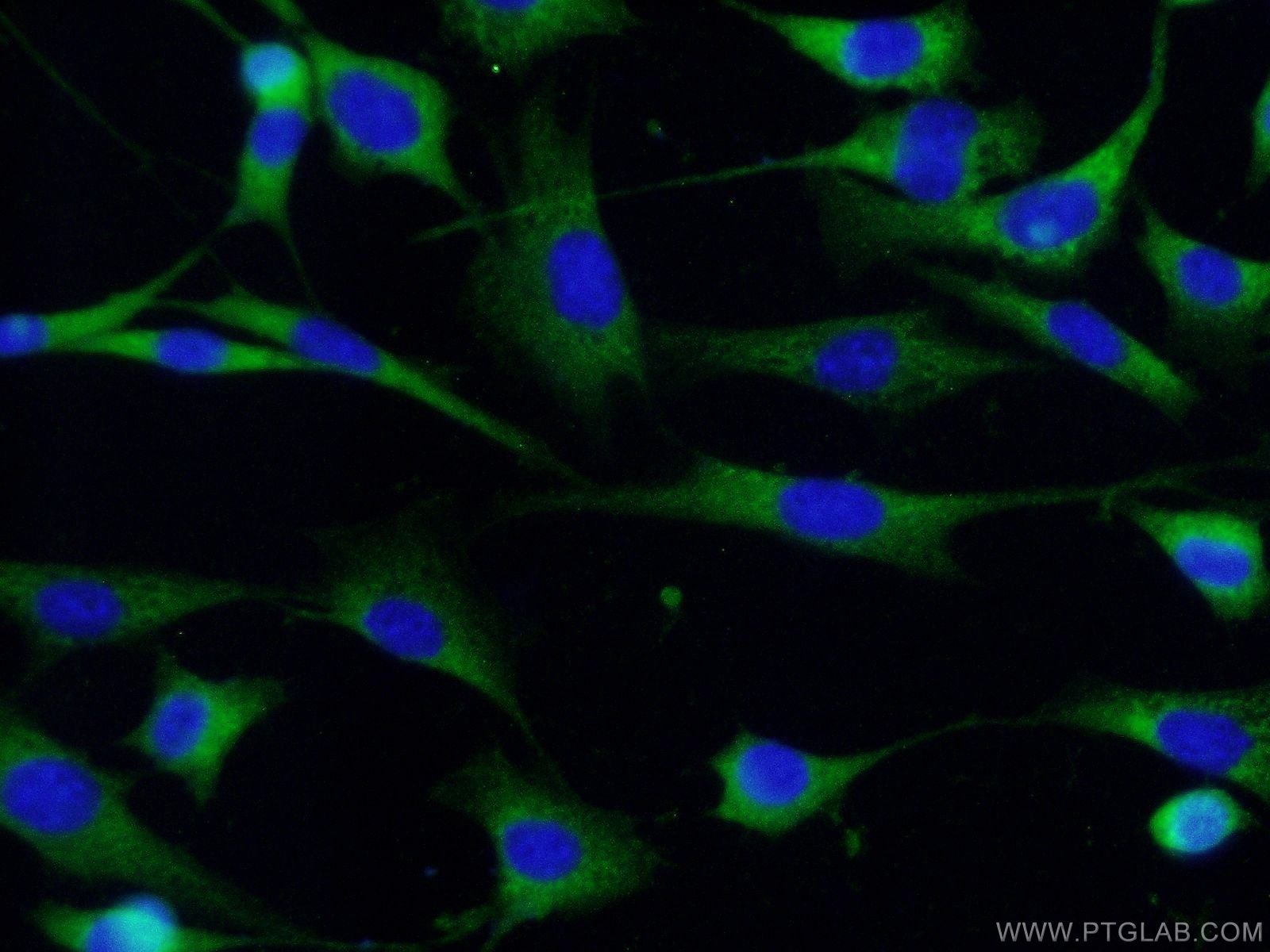 CDK5 Polyclonal antibody