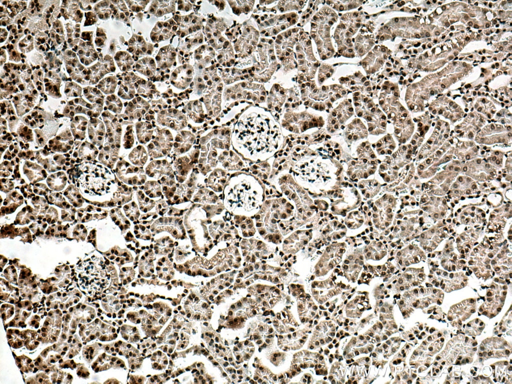 Immunohistochemistry (IHC) staining of mouse kidney tissue using CDK5 Polyclonal antibody (10430-1-AP)