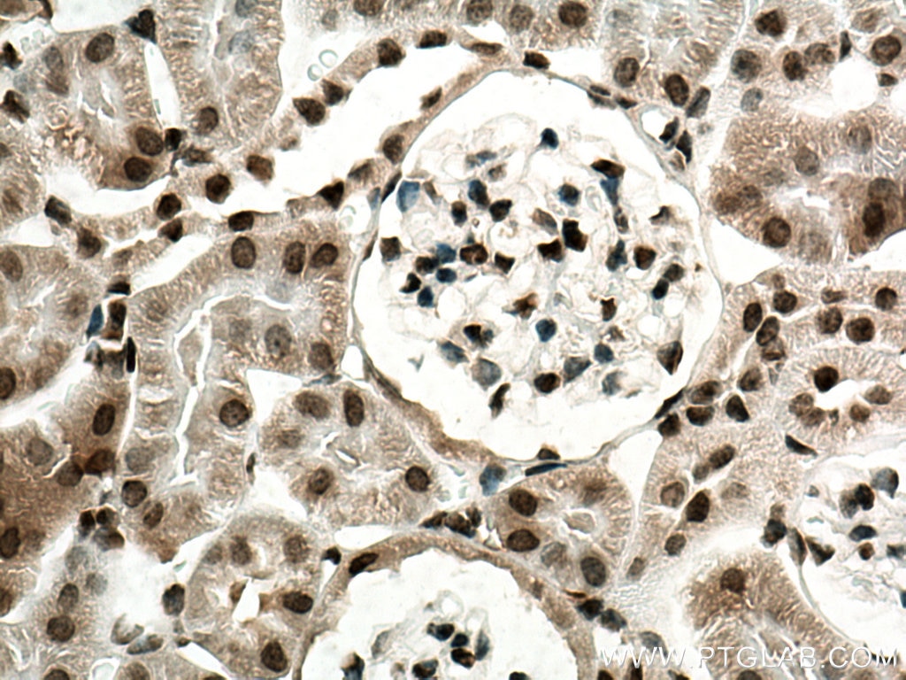 Immunohistochemistry (IHC) staining of mouse kidney tissue using CDK5 Polyclonal antibody (10430-1-AP)