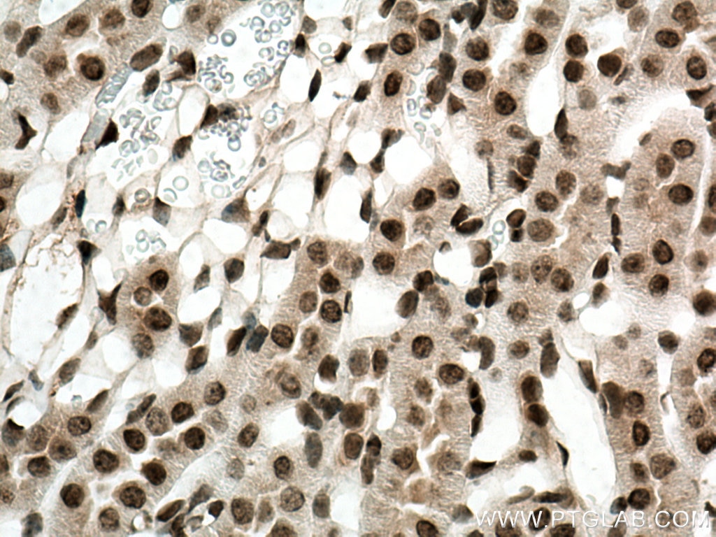Immunohistochemistry (IHC) staining of mouse kidney tissue using CDK5 Polyclonal antibody (10430-1-AP)