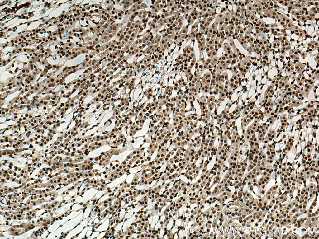 Immunohistochemistry (IHC) staining of mouse kidney tissue using CDK5 Polyclonal antibody (10430-1-AP)