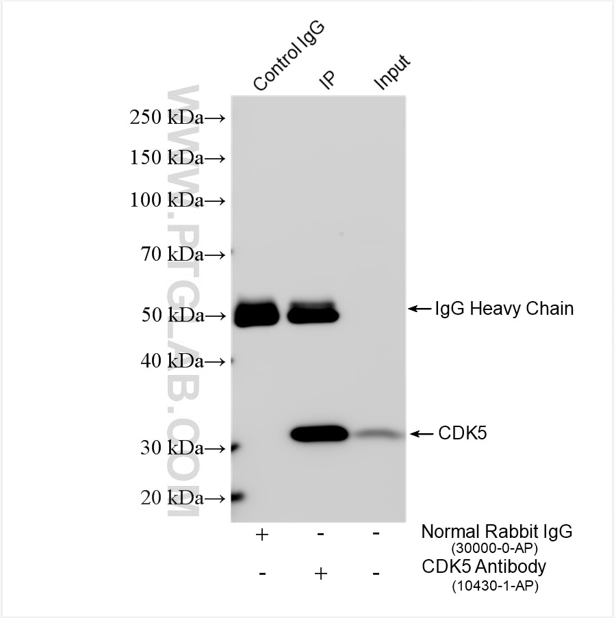 Immunoprecipitation (IP) experiment of mouse brain tissue using CDK5 Polyclonal antibody (10430-1-AP)