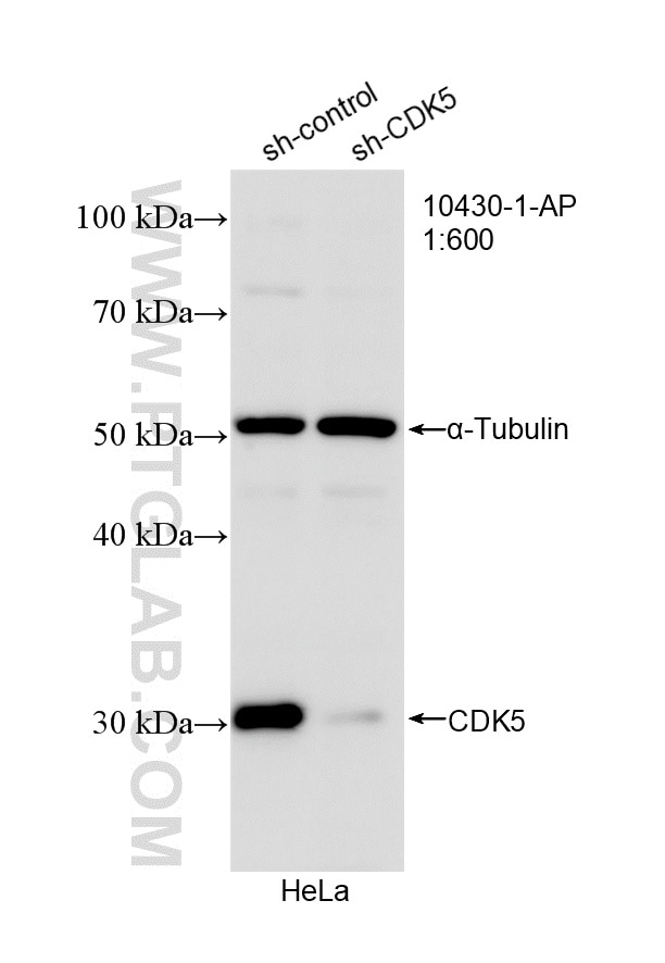 Western Blot (WB) analysis of HeLa cells using CDK5 Polyclonal antibody (10430-1-AP)