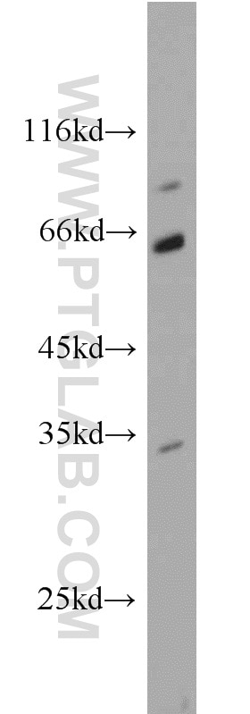Western Blot (WB) analysis of mouse pancreas tissue using CDK5 Polyclonal antibody (10430-1-AP)