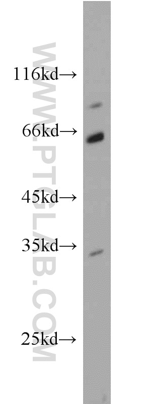 WB analysis of mouse pancreas using 10430-1-AP