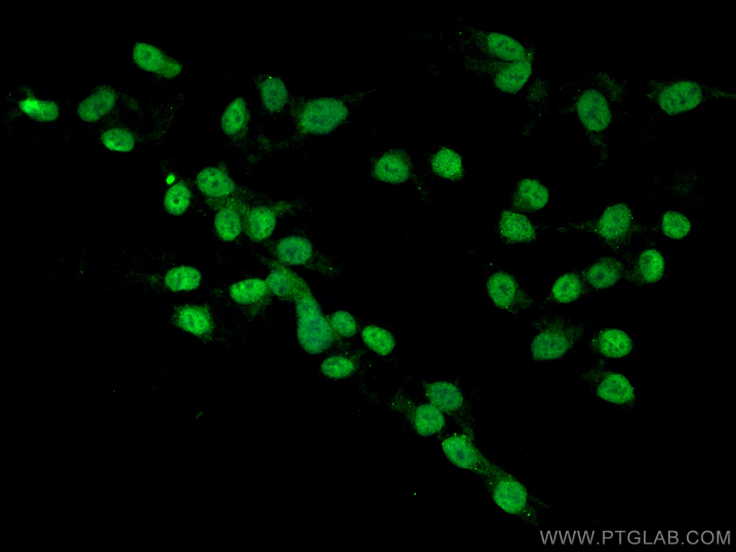 Immunofluorescence (IF) / fluorescent staining of SH-SY5Y cells using CDK5 Monoclonal antibody (68514-1-Ig)