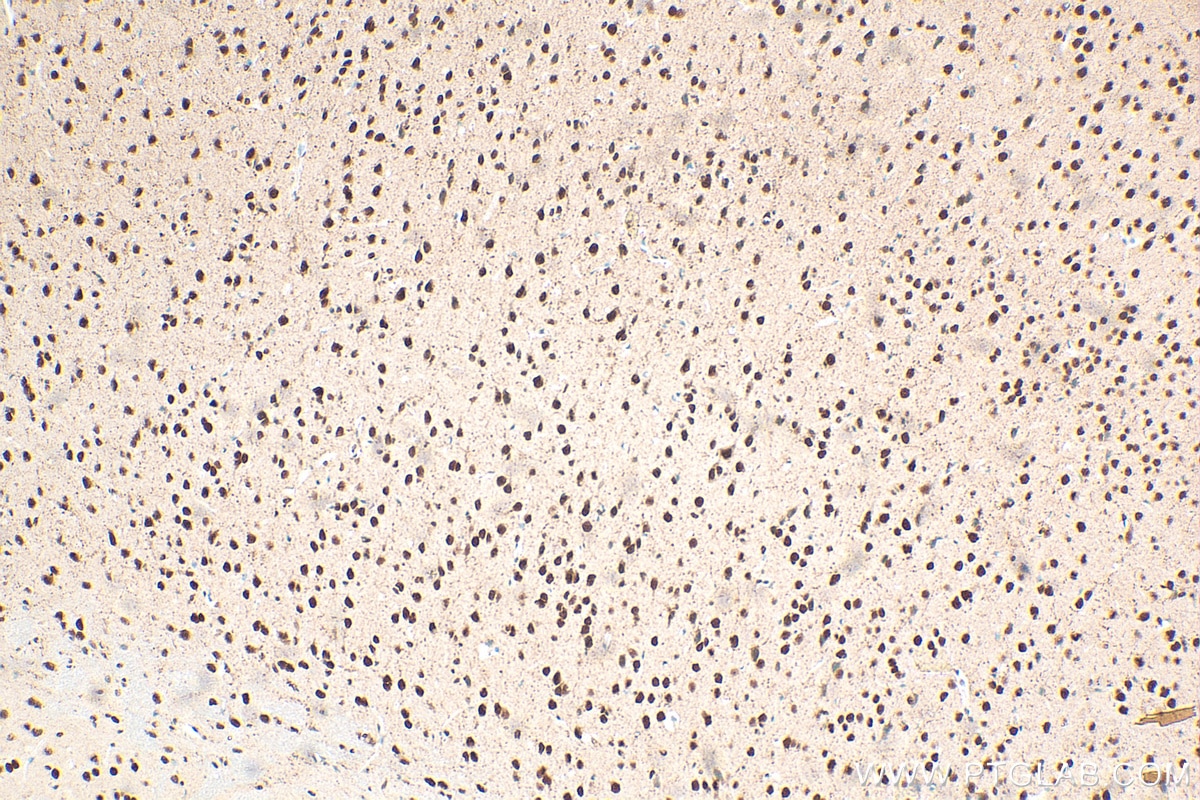 Immunohistochemistry (IHC) staining of mouse brain tissue using CDK5 Monoclonal antibody (68514-1-Ig)