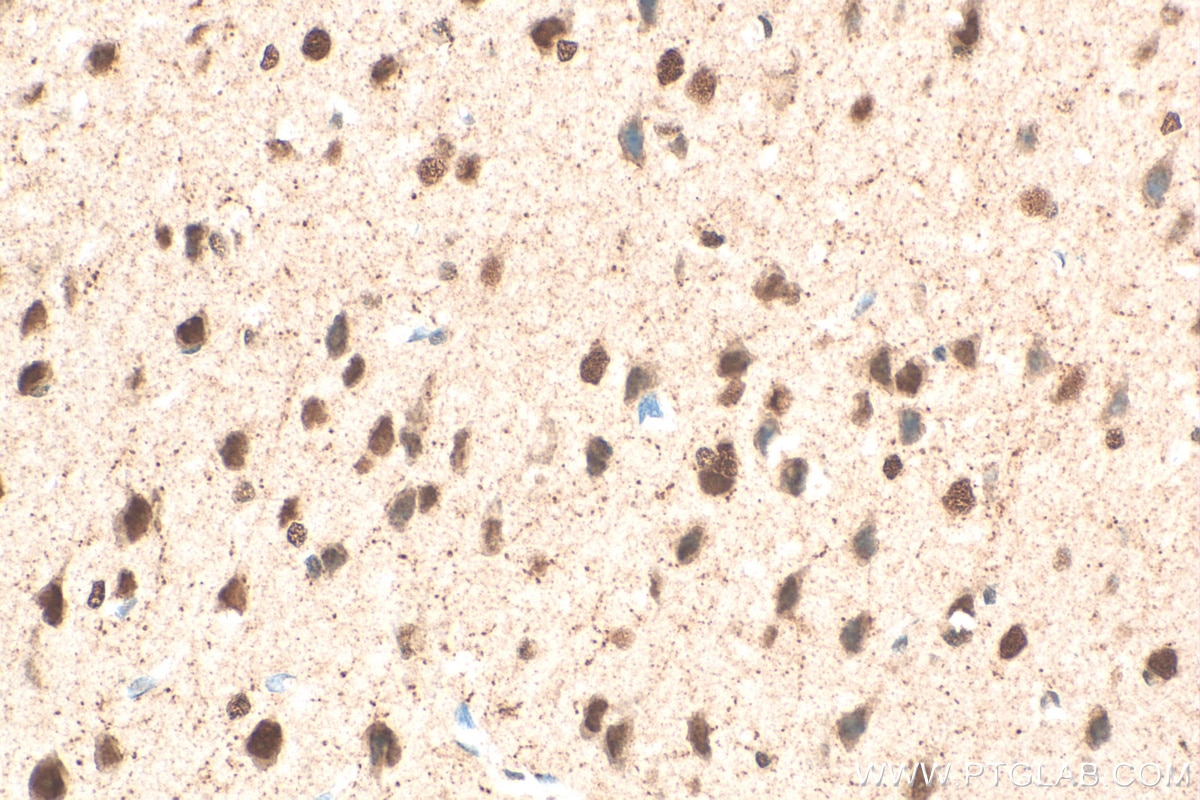 Immunohistochemistry (IHC) staining of mouse brain tissue using CDK5 Monoclonal antibody (68514-1-Ig)