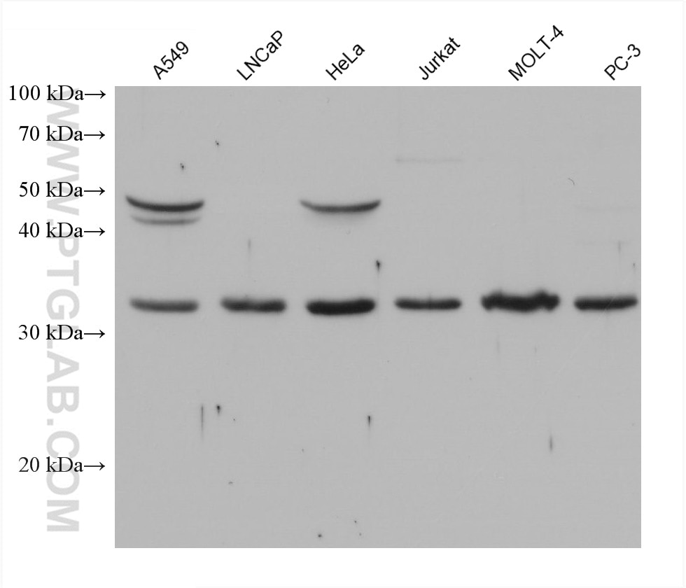 Western Blot (WB) analysis of various lysates using CDK5 Monoclonal antibody (68514-1-Ig)