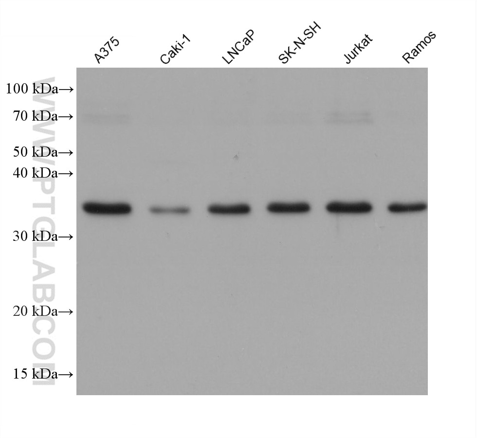 Western Blot (WB) analysis of various lysates using CDK5 Monoclonal antibody (68514-1-Ig)
