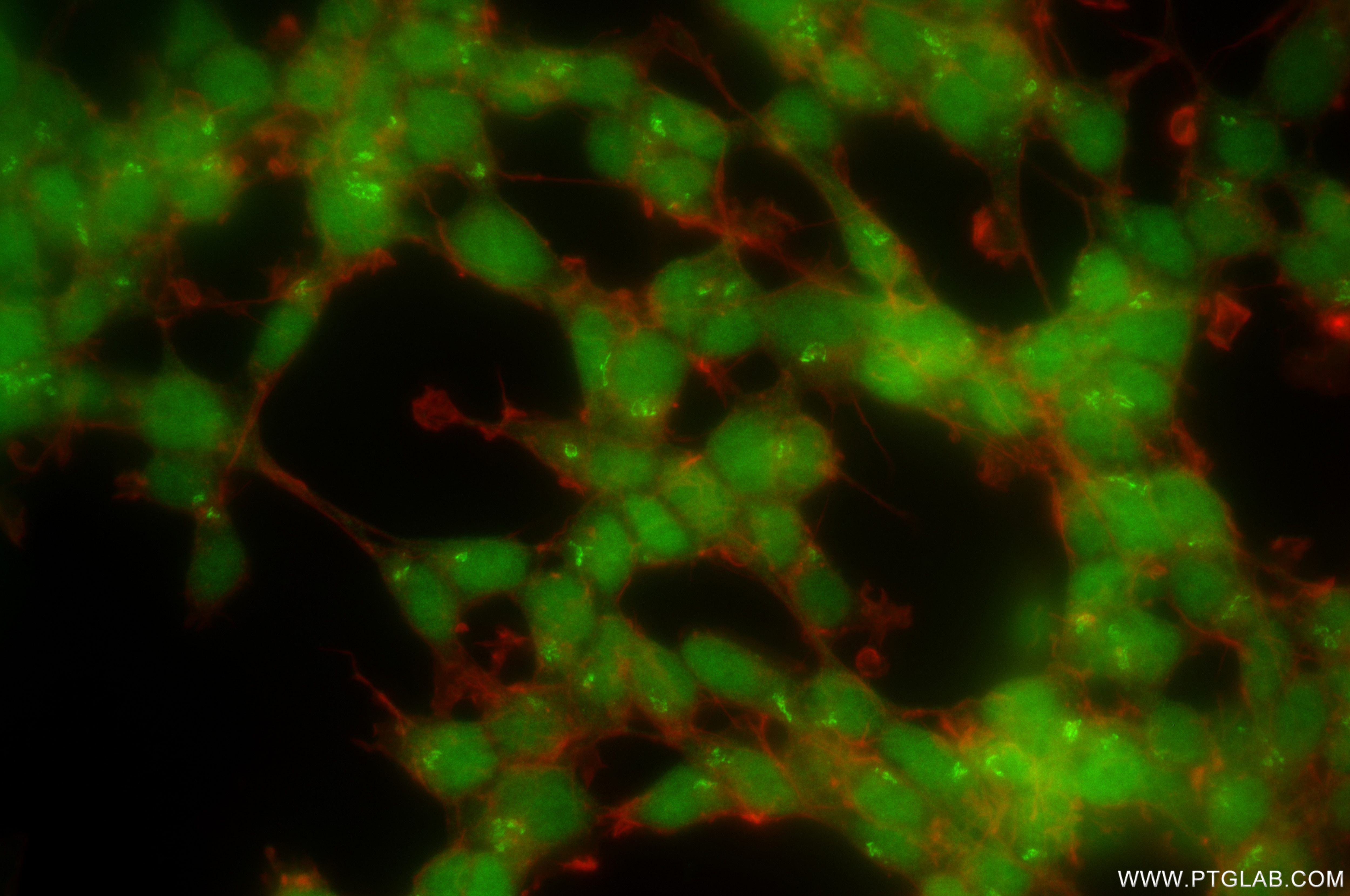 Immunofluorescence (IF) / fluorescent staining of SH-SY5Y cells using CDK5 Recombinant antibody (84749-1-RR)