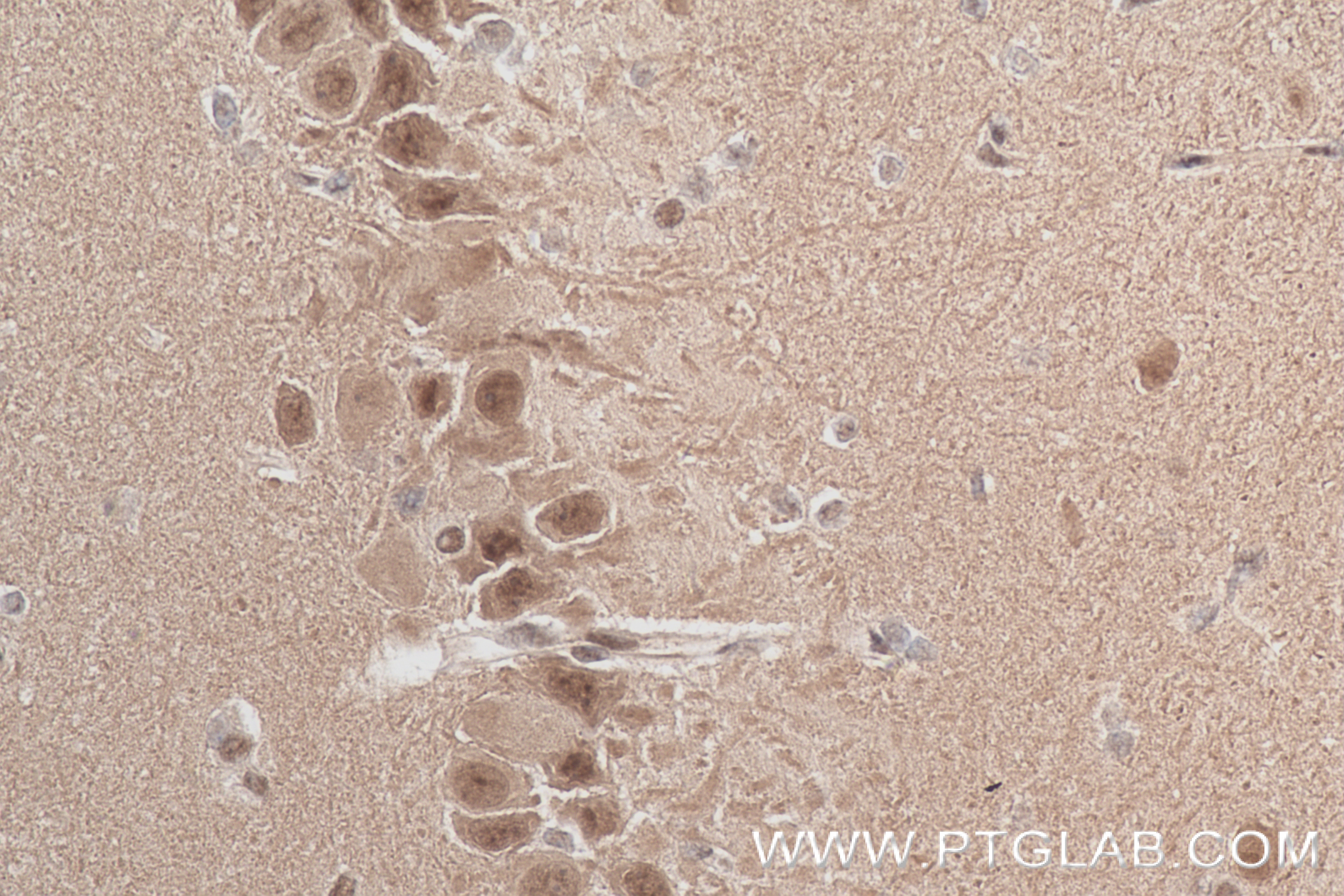 Immunohistochemistry (IHC) staining of rat brain tissue using CDK5 Recombinant antibody (84749-1-RR)