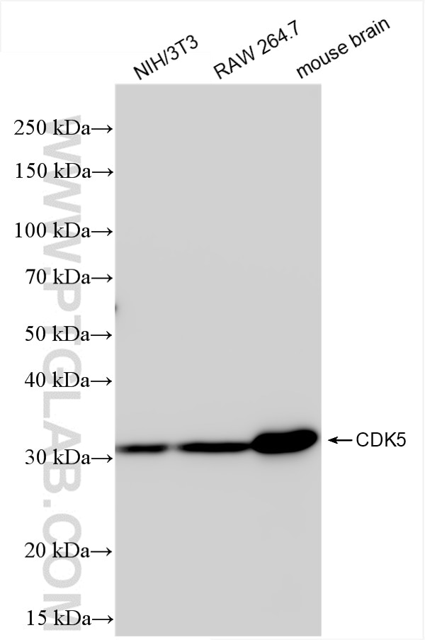 Western Blot (WB) analysis of various lysates using CDK5 Recombinant antibody (84749-1-RR)