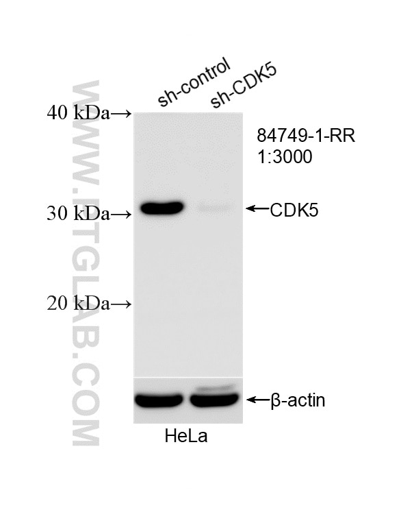 Western Blot (WB) analysis of HeLa cells using CDK5 Recombinant monoclonal antibody (84749-1-RR)