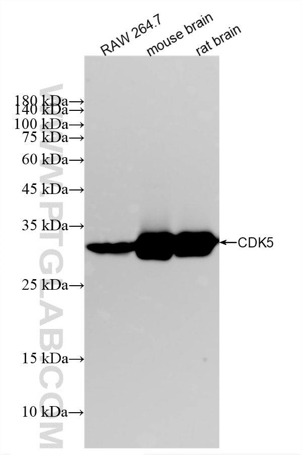 WB analysis using 84749-1-RR Western Blot (WB) analysis of various lysates using CDK5 Recombinant monoclonal antibody (84749-1-RR)