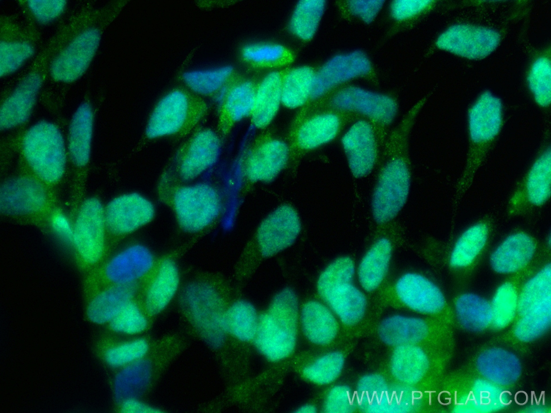 Immunofluorescence (IF) / fluorescent staining of SH-SY5Y cells using CoraLite® Plus 488-conjugated CDK5 Polyclonal anti (CL488-10430)