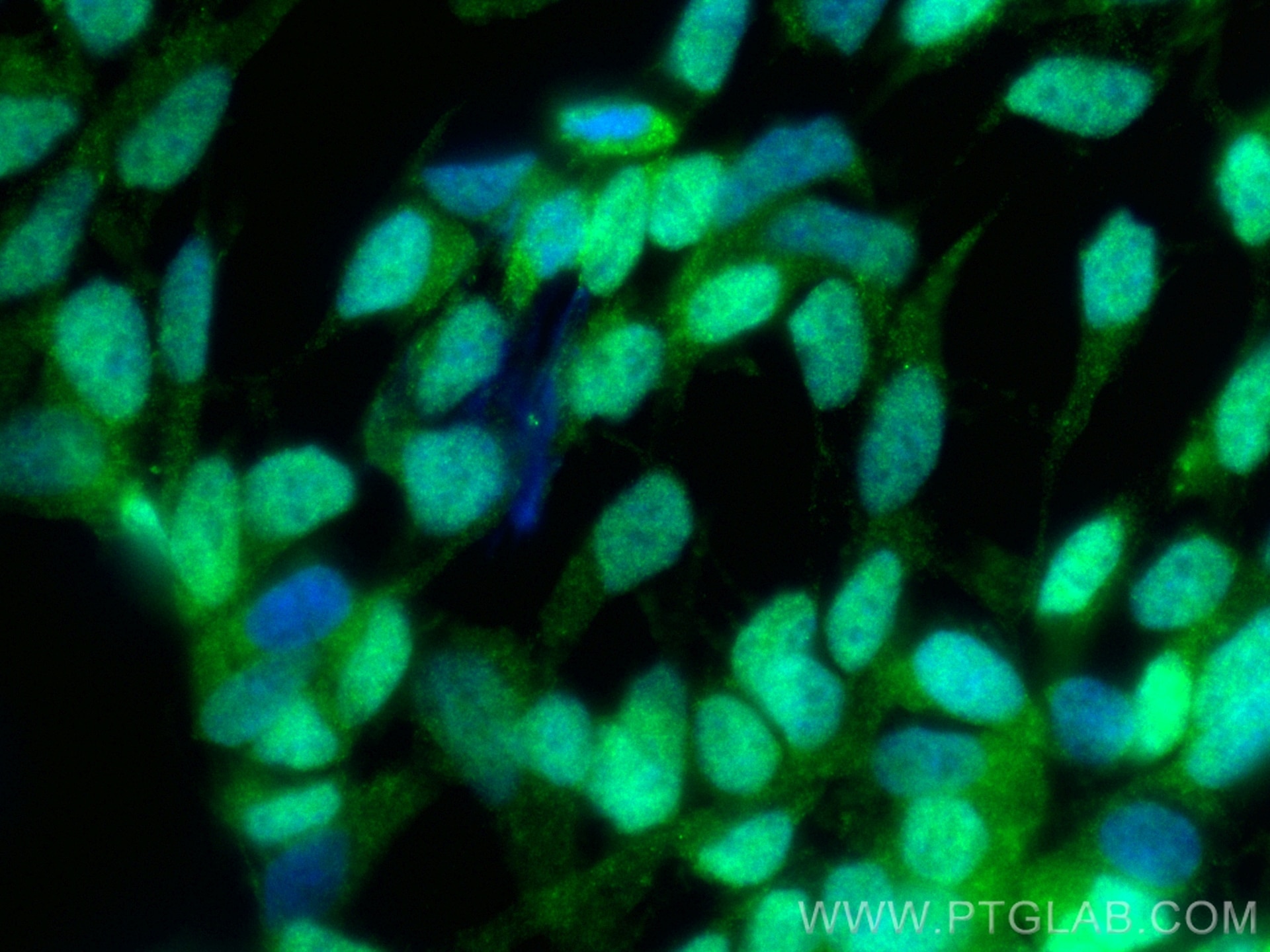 IF Staining of SH-SY5Y using CL488-10430