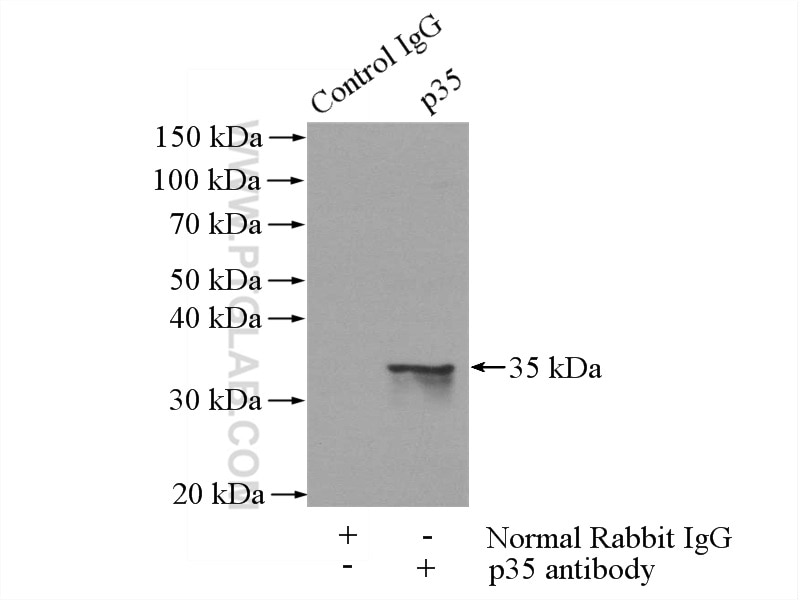 Immunoprecipitation (IP) experiment of mouse brain tissue using p35 Polyclonal antibody (18346-1-AP)