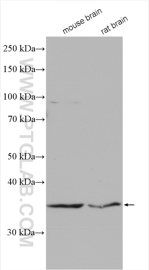 Western Blot (WB) analysis of various lysates using p35 Polyclonal antibody (18346-1-AP)