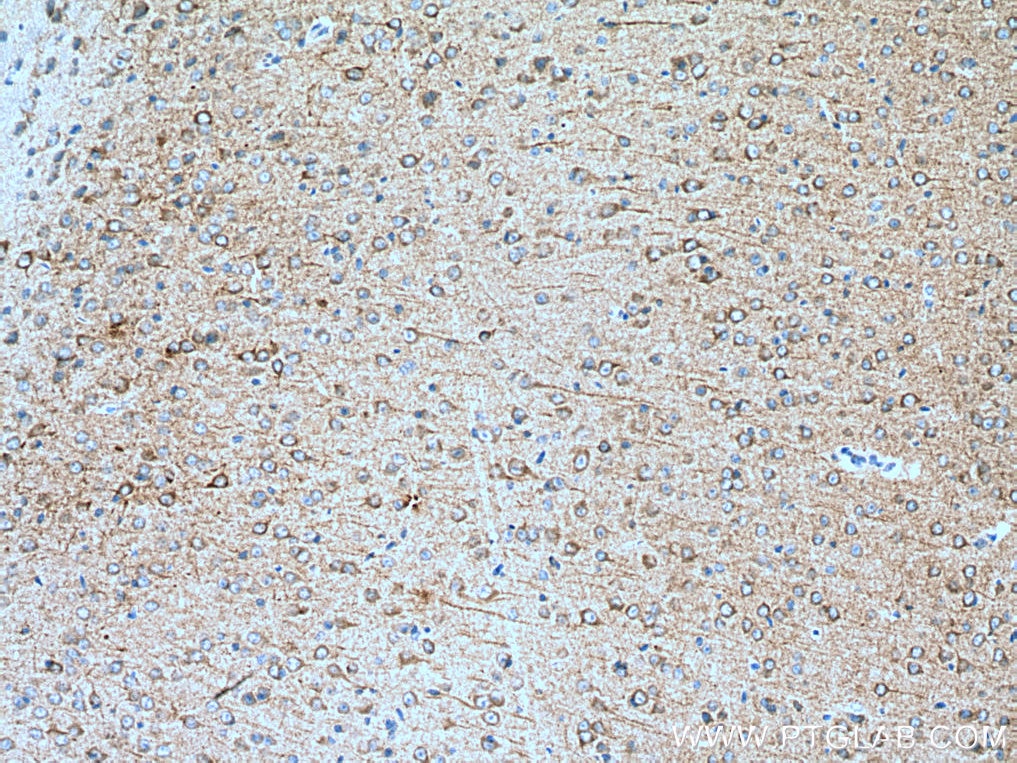 Immunohistochemistry (IHC) staining of mouse brain tissue using CDK5R1 Monoclonal antibody (67503-1-Ig)