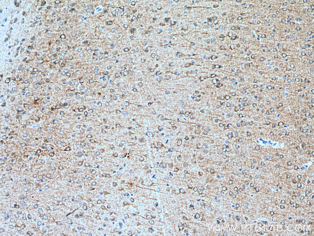 IHC staining of mouse brain using 67503-1-Ig