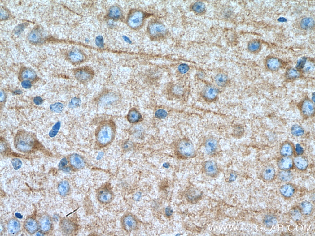 Immunohistochemistry (IHC) staining of mouse brain tissue using CDK5R1 Monoclonal antibody (67503-1-Ig)