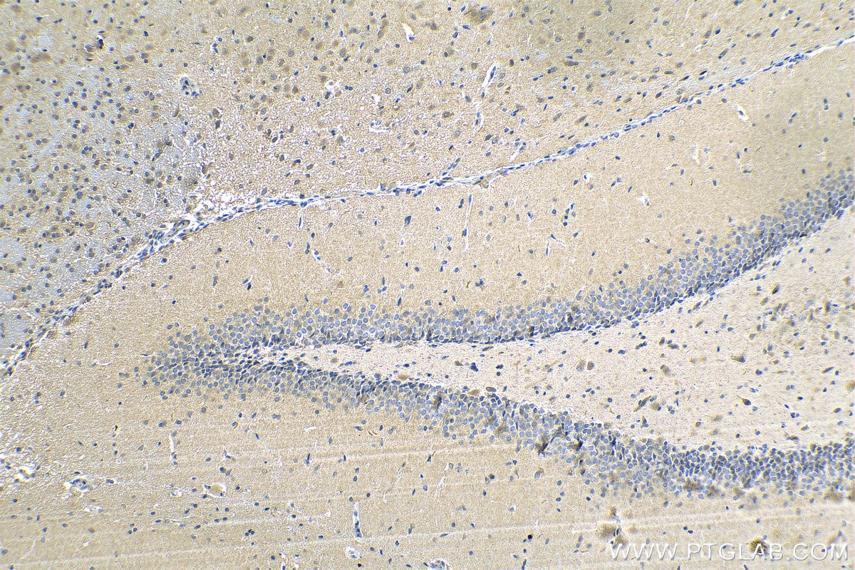 Immunohistochemistry (IHC) staining of rat brain tissue using CDK5R1 Monoclonal antibody (67503-1-Ig)