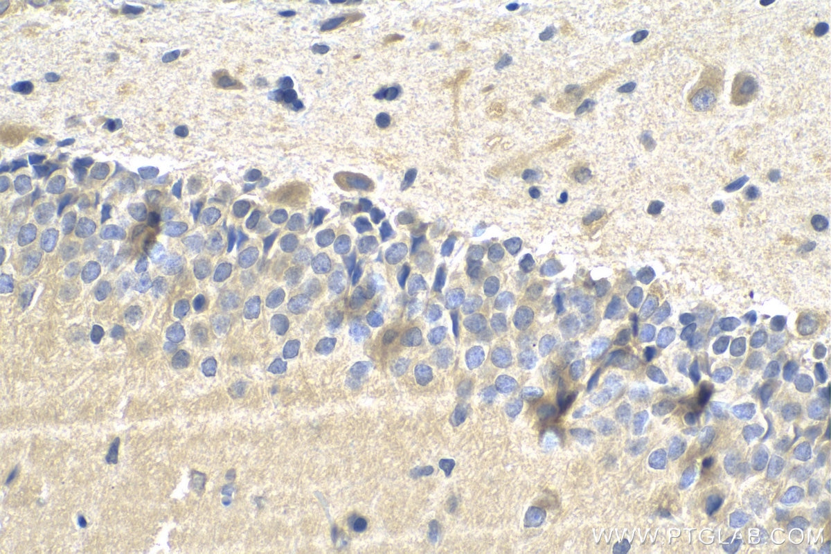 Immunohistochemistry (IHC) staining of rat brain tissue using CDK5R1 Monoclonal antibody (67503-1-Ig)