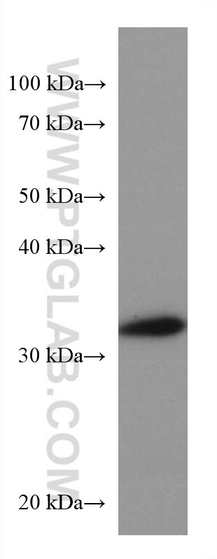 Western Blot (WB) analysis of rat brain tissue using CDK5R1 Monoclonal antibody (67503-1-Ig)