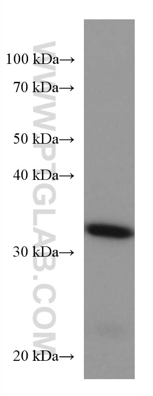 Western Blot (WB) analysis of mouse brain tissue using CDK5R1 Monoclonal antibody (67503-1-Ig)