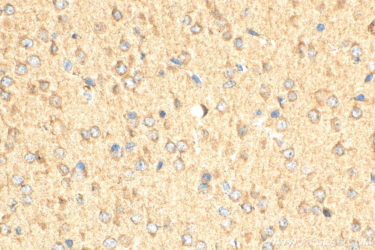 Immunohistochemistry (IHC) staining of mouse brain tissue using CDK5R2/p39 Polyclonal antibody (27058-1-AP)