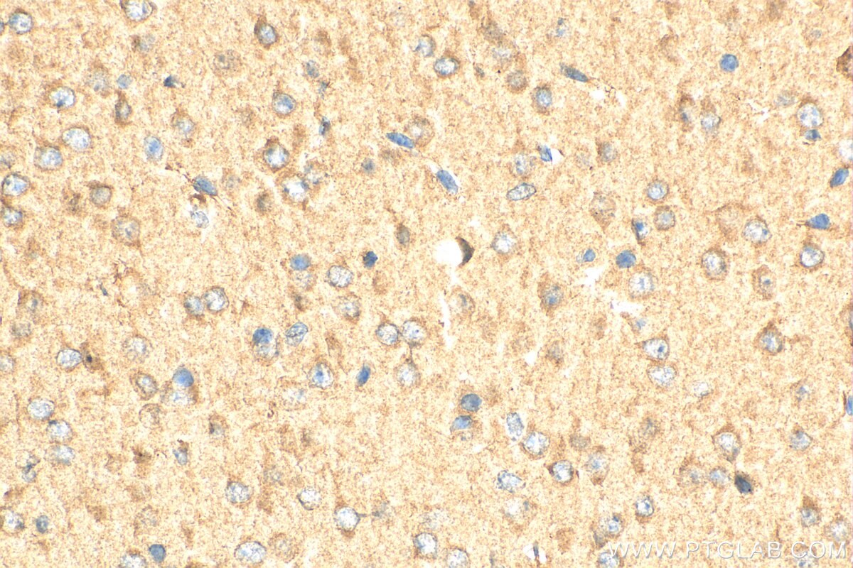 Immunohistochemistry (IHC) staining of mouse brain tissue using CDK5R2/p39 Polyclonal antibody (27058-1-AP)