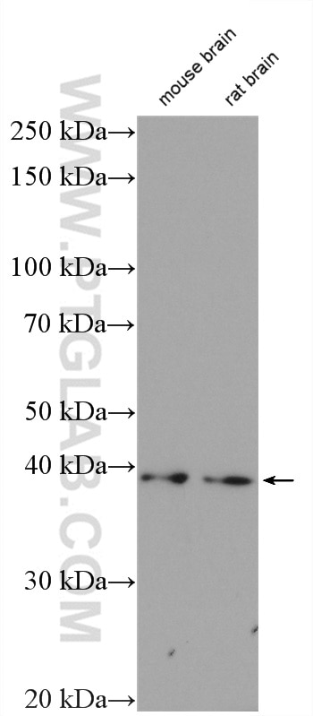 Western Blot (WB) analysis of various lysates using CDK5R2/p39 Polyclonal antibody (27058-1-AP)