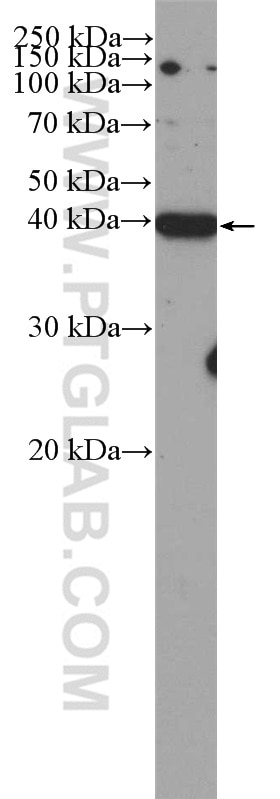 Western Blot (WB) analysis of Neuro-2a cells using CDK5R2/p39 Polyclonal antibody (27058-1-AP)